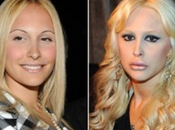 Noemi Letizia prima dopo