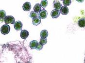 stanchezza cronica causata virus