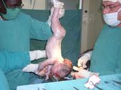 mondo /Ogni giorno muoiono parto mille donne