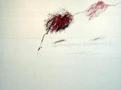 Achilles Mourning Death Patroclus (Rome)