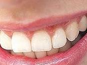 Denti perfetti ogni