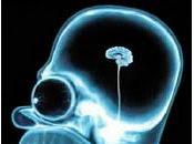 Aiuto. rimpicciolito cervello