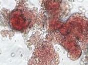 Nuovi promettenti impieghi cellule staminali cordone ombelicale