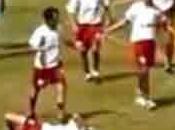 Cile: pugno dell'arbitro calciatore, caccia all'uomo (video)
