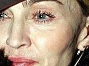 Madonna Compie Anni Festeggia Chirurgo?
