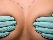 Chirurgia plastica: rifarsi seno