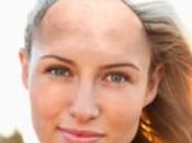 Gratis iPhone Baldify